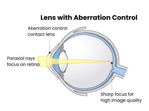 Lens with Aberration Control Aberration control  contact lens Paraxial rays focus on retina Sharp focus for high image quality